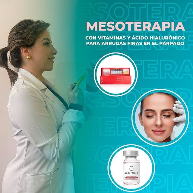 Mesoterapia: Con vitaminas y ácido Hialurónico