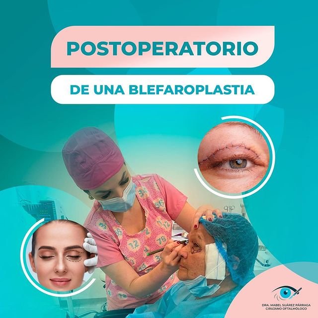 Postoperatorio de una blefaroplastia